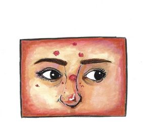 Dermatillomania Self Portrait