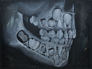 Milk Teeth 1