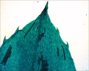 Hydrilla verticillata Leaf Tip
